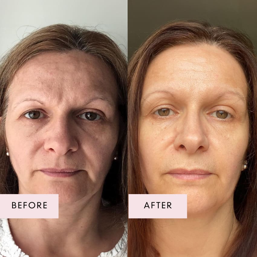 Pink Collagen Volufiline Balm