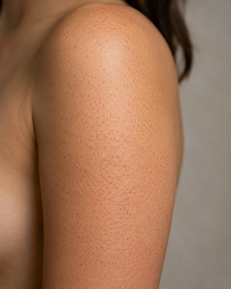 Arm with strawberry skin texture