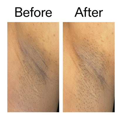 Glycolic Acid Exfoliating Body Stick