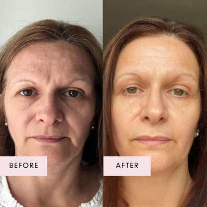 Pink Collagen Volufiline Balm